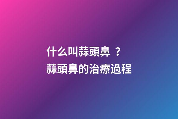 什么叫蒜頭鼻？蒜頭鼻的治療過程